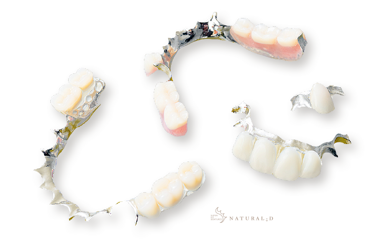 院長独自開発の義歯「ナチュラル-D」